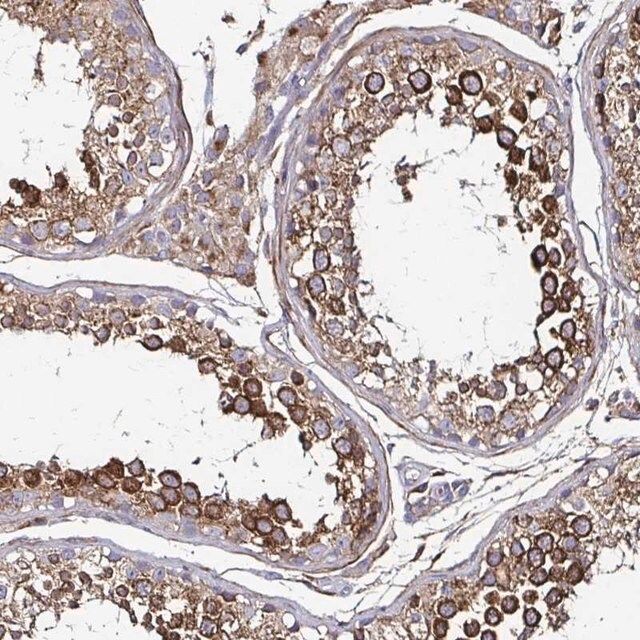 Anti-NCSTN antibody produced in rabbit