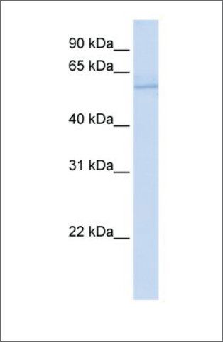 Anti-ND5 antibody produced in rabbit