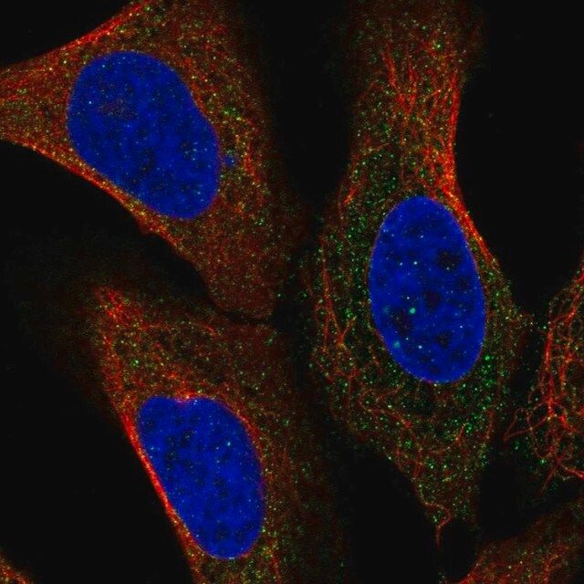 Anti-NCSTN antibody produced in rabbit