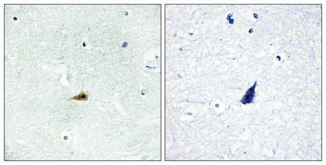 Anti-NCOR2 antibody produced in rabbit