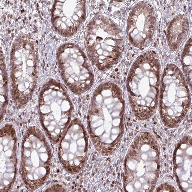 Anti-NCOR1 antibody produced in rabbit