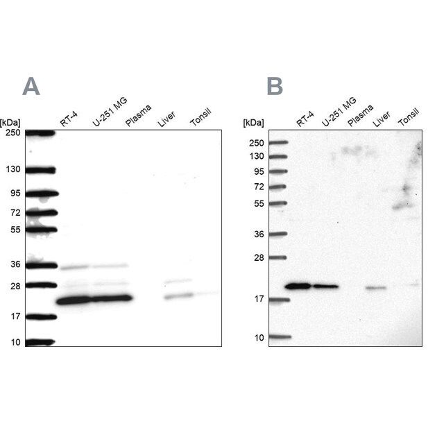 Anti-NDUFAF2 antibody produced in rabbit