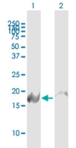 Anti-NDUFB6 antibody produced in mouse