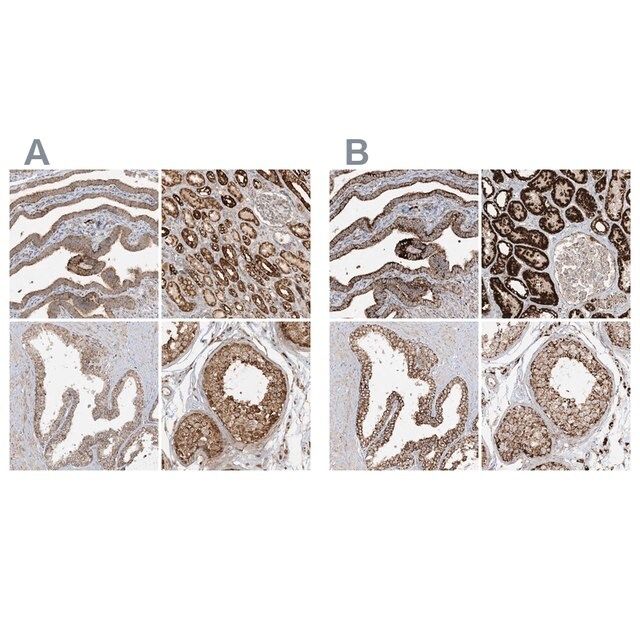 Anti-NDUFAF3 antibody produced in rabbit