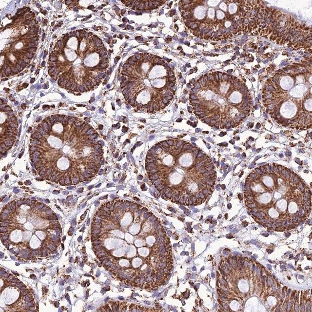 Anti-NDUFAF1 antibody produced in rabbit