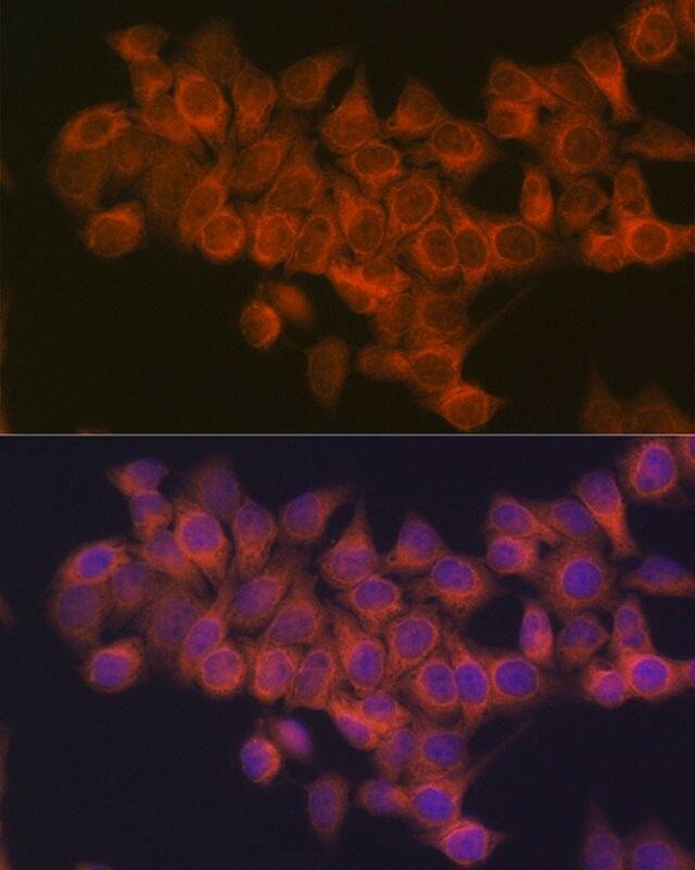 Anti-NDUFAF1 antibody produced in rabbit