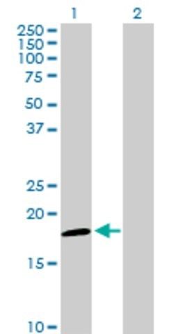 Anti-NDUFAB1 antibody produced in rabbit