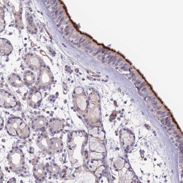 Anti-NDUFAF5 antibody produced in rabbit