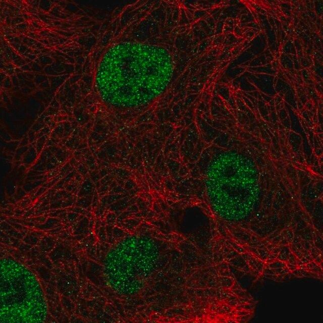 Anti-NEIL2 antibody produced in rabbit