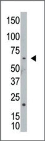 Anti-NEK8 (N-term) antibody produced in rabbit