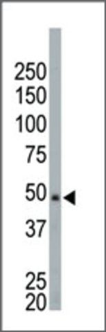 Anti-NEK2 (center) antibody produced in rabbit