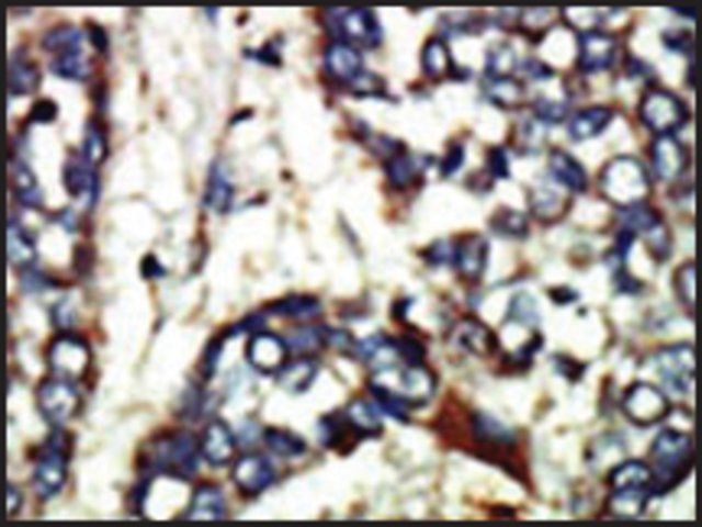 Anti-NEK1 (C-term) antibody produced in rabbit