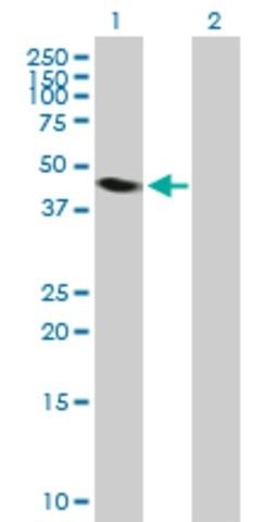 Anti-NEIL1 antibody produced in mouse