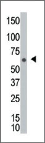 Anti-NEK8 (C-term) antibody produced in rabbit