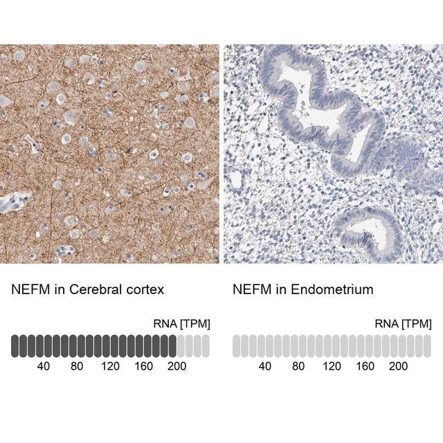 Anti-NEFM antibody produced in rabbit