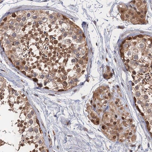 Anti-NEK8 antibody produced in rabbit