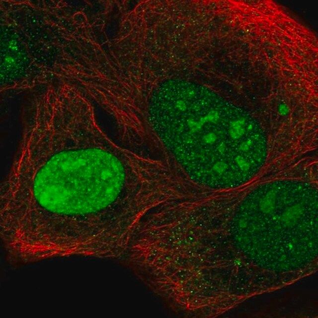 Anti-NEPRO antibody produced in rabbit