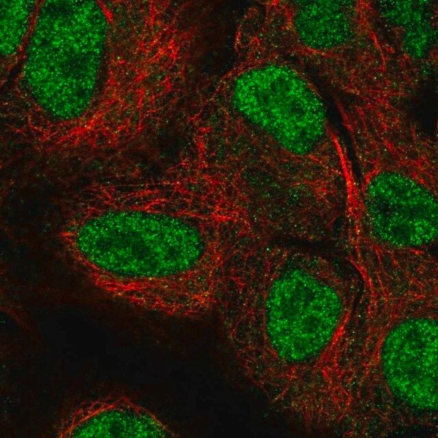 Anti-NEIL2 antibody produced in rabbit