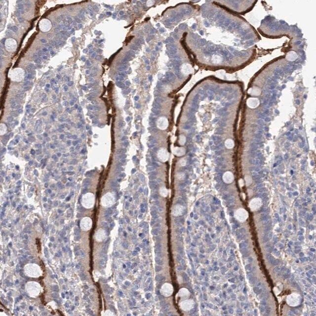 Anti-NEK10 antibody produced in rabbit