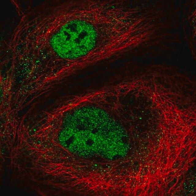 Anti-NEMP2 antibody produced in rabbit