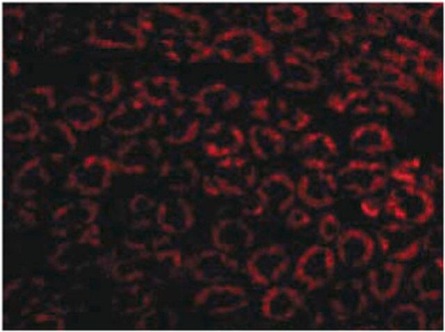 Anti-Nephrin Antibody