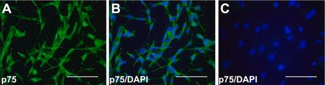 Anti-Nerve Growth Factor Receptor Antibody, extracellular, clone 192-IgG