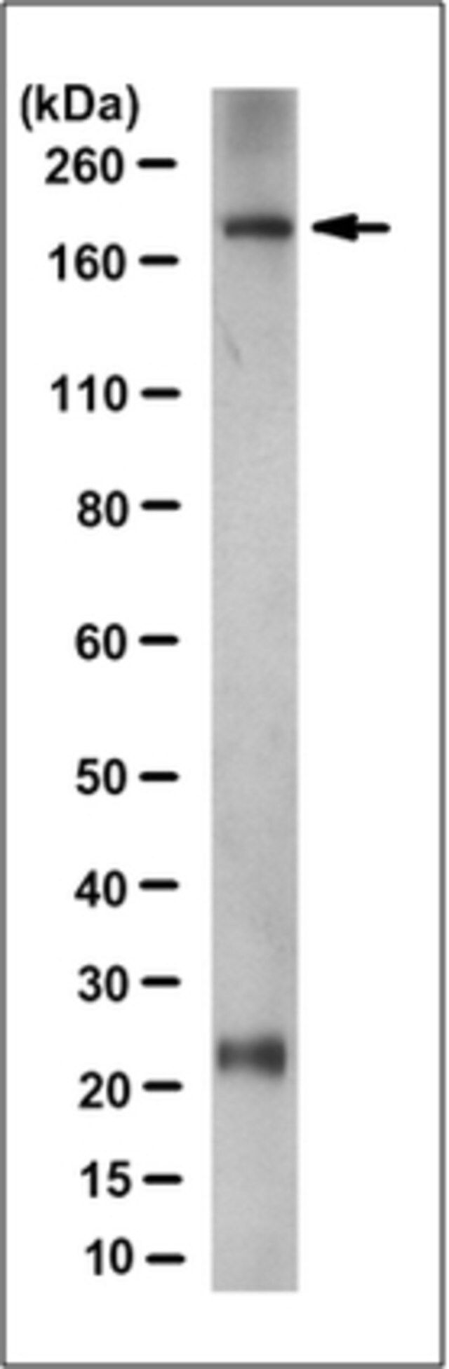 Anti-Nephrin Antibody, clone 3B6.1