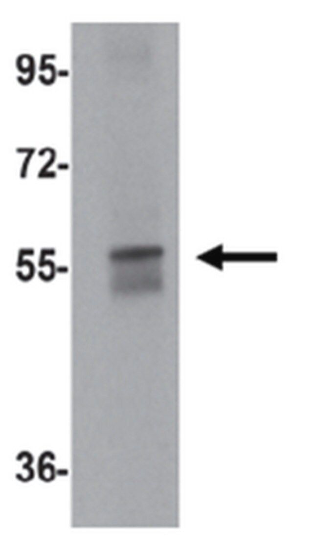 Anti-NETO1 Antibody