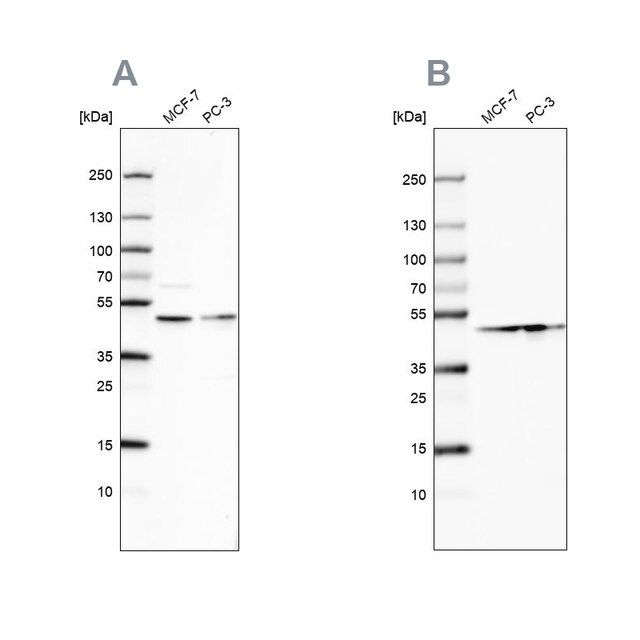 Anti-NELFE antibody produced in rabbit