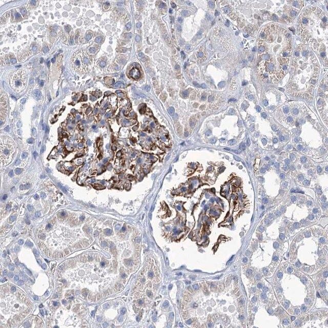 Anti-NEU3 antibody produced in rabbit