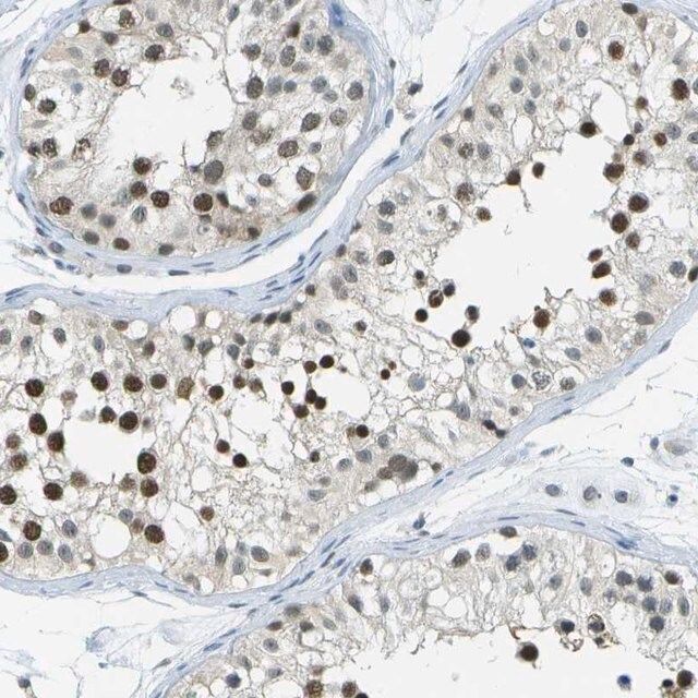 Anti-NEK11 antibody produced in rabbit