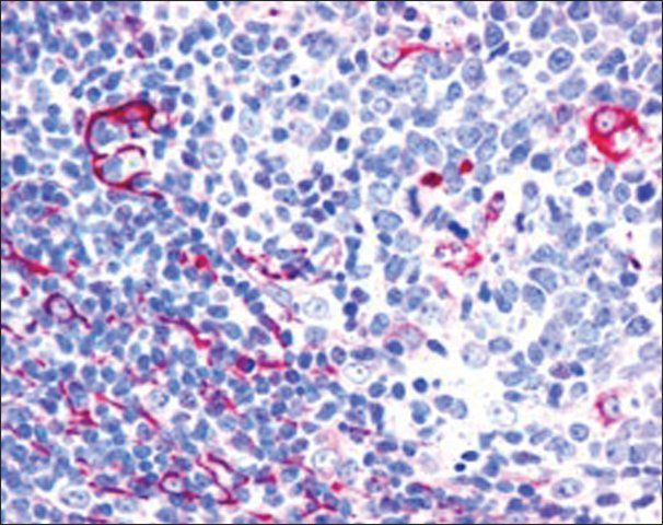 Anti-NET1/ARHGEF8, C-Terminal antibody produced in goat