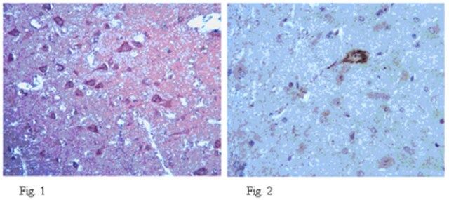 Anti-Neurexin3 Antibody