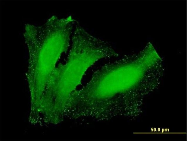 Anti-NETO2 antibody produced in mouse