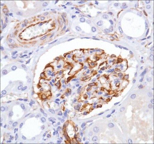 Anti-Nestin antibody, Rabbit monoclonal