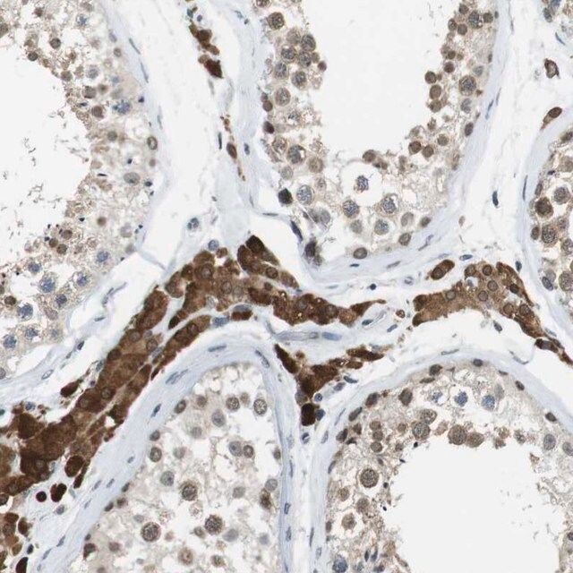 Anti-NEK4 antibody produced in rabbit