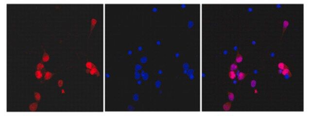 Anti-NeuN (rabbit monoclonal) Antibody, clone 27-4