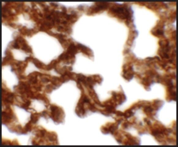 Anti-NETO1 antibody produced in rabbit