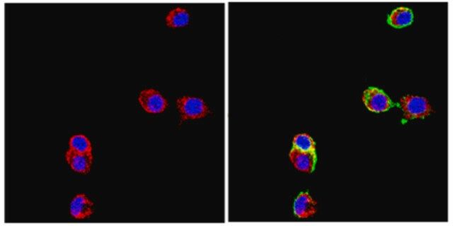 Anti-Neural Cell Adhesion Molecule L1 Antibody, clone 324