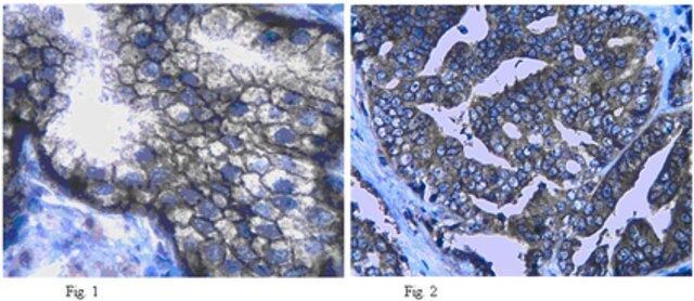 Anti-Neutral amino acid transporter (ASCT2) Antibody