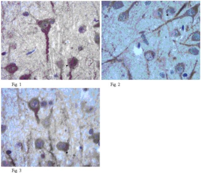 Anti-Neurexin-1-alpha Antibody