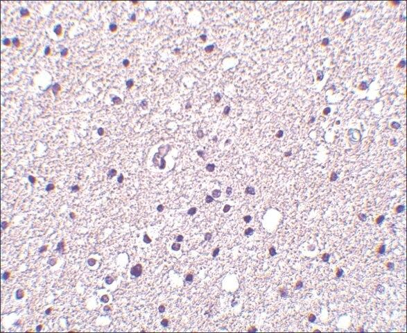 Anti-Neurotrypsin antibody produced in rabbit