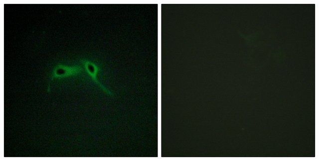 Anti-NF1 antibody produced in rabbit