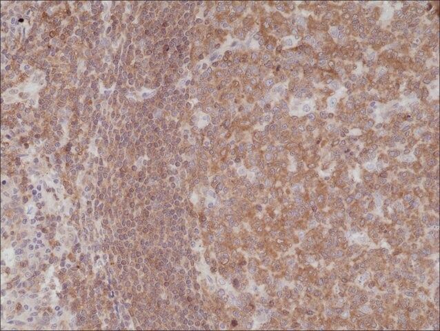 Anti-NF-kappa-B p105/p50 antibody, Rabbit Monoclonal