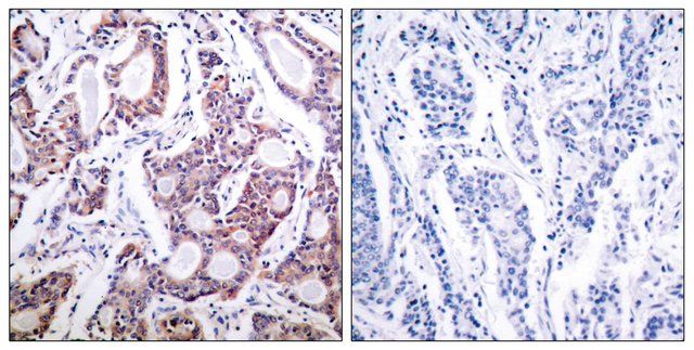 Anti-NF-B p100 antibody produced in rabbit