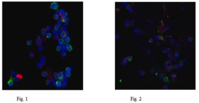 Anti-Neutrophil Elastase Antibody, clone AHN-10