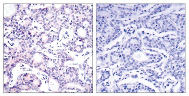 Anti-NF-B p105 antibody produced in rabbit