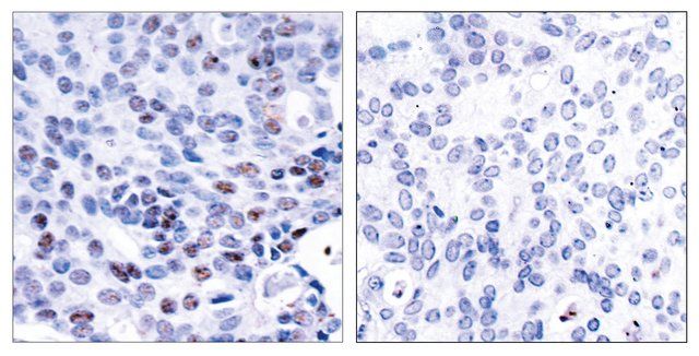 Anti-NF-B p105 antibody produced in rabbit