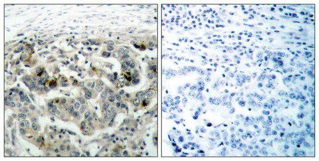 Anti-NF-B p105 antibody produced in rabbit