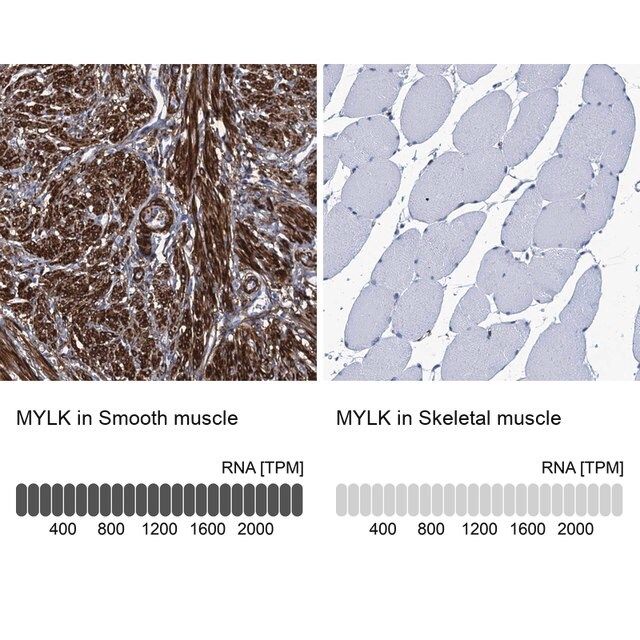 Anti-MYLK antibody produced in rabbit